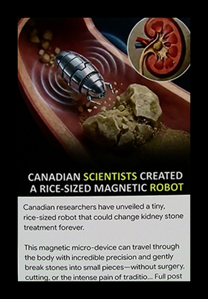 Tiny robots can eat your guts from inside now, how nice (171K)